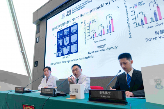 港大醫學院研究團隊成功研發一種新型彈性磷酸鈣「納米仿天然骨」材料，有望成為替代傳統骨移植的骨科治療方案。研究團隊包括（左起）黃德民教授、楊偉國教授及吴隽博士。
 